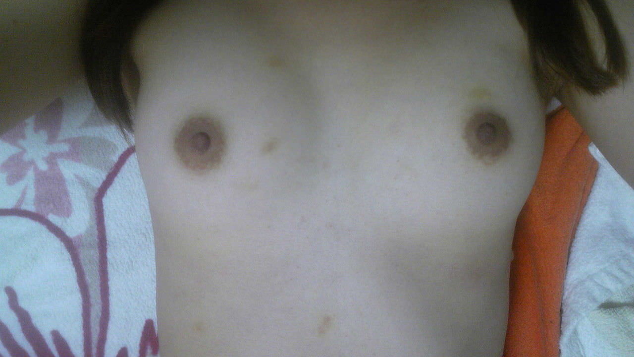 eroangle4274_06